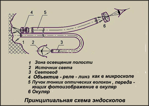 Части эндоскопа. Схема построения волоконно-оптического эндоскопа. Схема линзового эндоскопа. Технический эндоскоп схема. Оптический эндоскоп устройство.