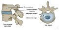 Intervertebral Disk.jpg